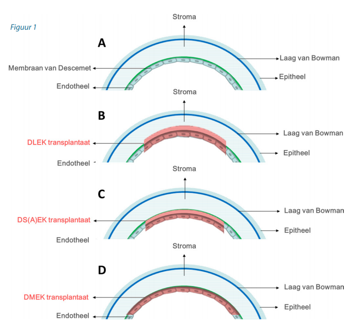 OPHTALMOLOGIE3